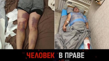 Домашний террор арендодателей и пределы необходимой самообороны 07.06.2025