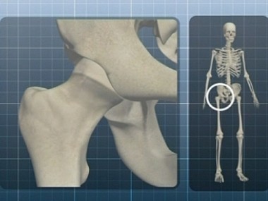 Силикон, анатомия протеза, умная техника