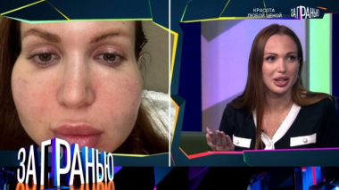 «Красота любой ценой» 18.10.2025