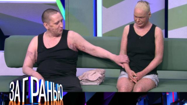 За гранью / «Любовь вопреки диагнозам» / 20.05.2026